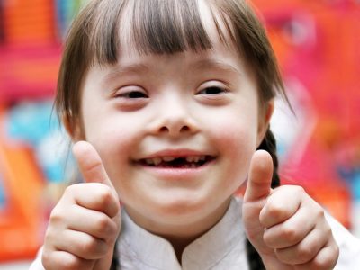 sindrome-de-down1